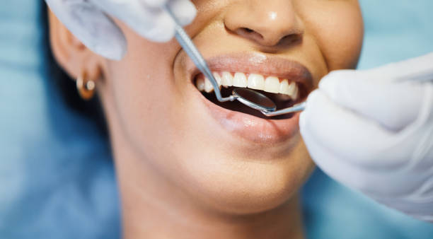 Best Emergency Treatment for Dental Infections or Abscesses in Donaldsonville, LA