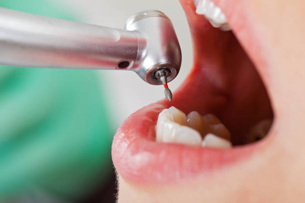 Best Pediatric Emergency Dentist in Donaldsonville, LA